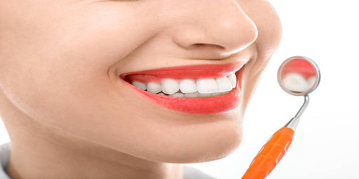 Best Gummy Smile Correction In India