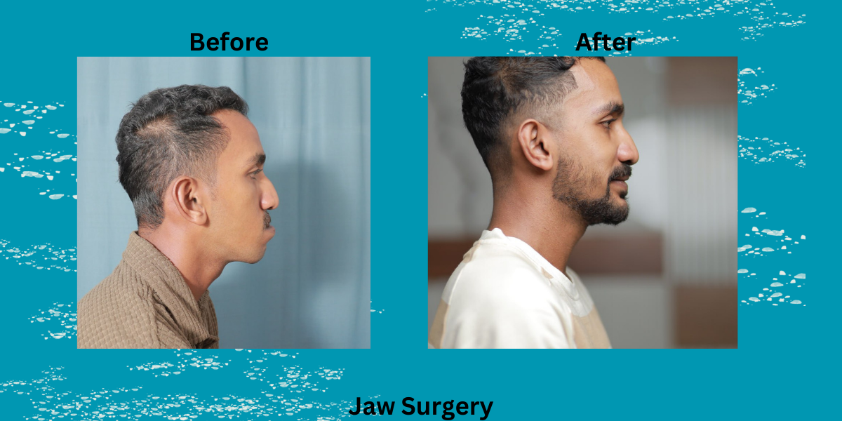 Top 7 Reasons to Choose Jaw Surgery in Kerala with Dr. Mathew PC