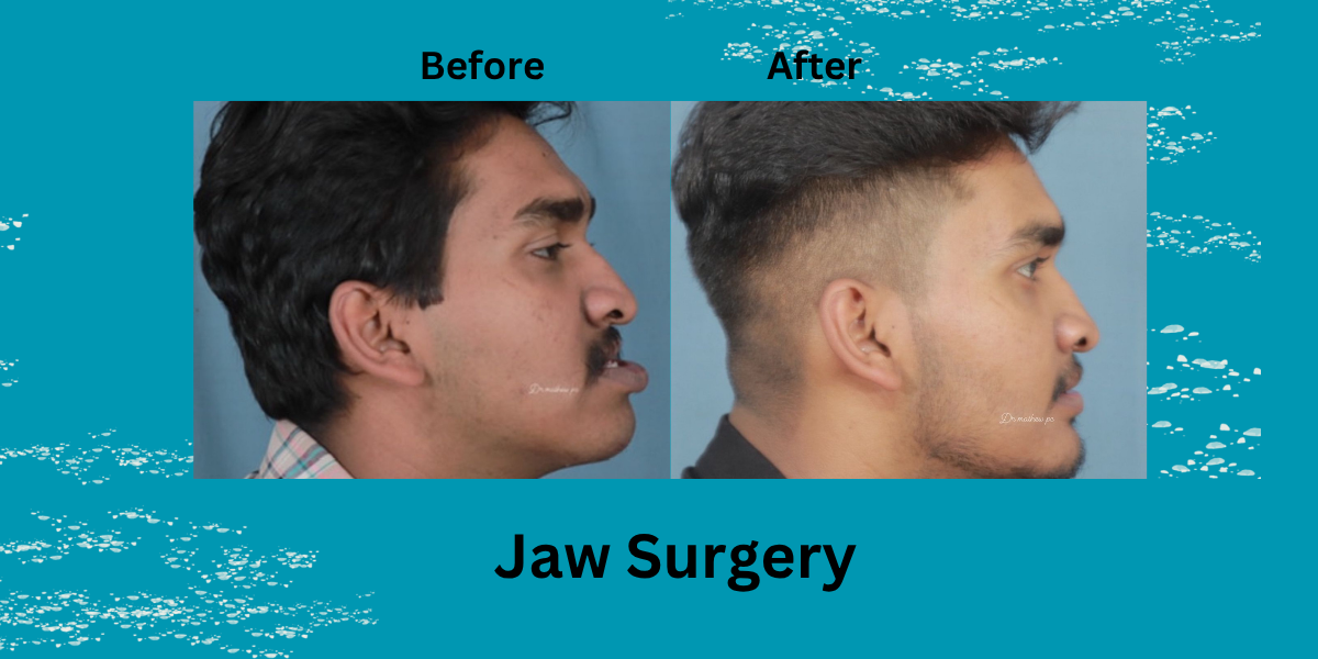 Do You Need Chin or Jaw Surgery? Here’s How to Tell (2025 Guide)