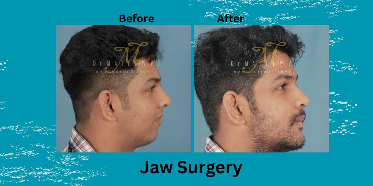 Facial Harmony: Understanding the Golden Ratio in Facial Surgery