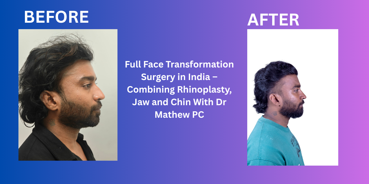 Full Face Transformation Surgery in India – Combining Rhinoplasty, Jaw and Chin With Dr Mathew PC