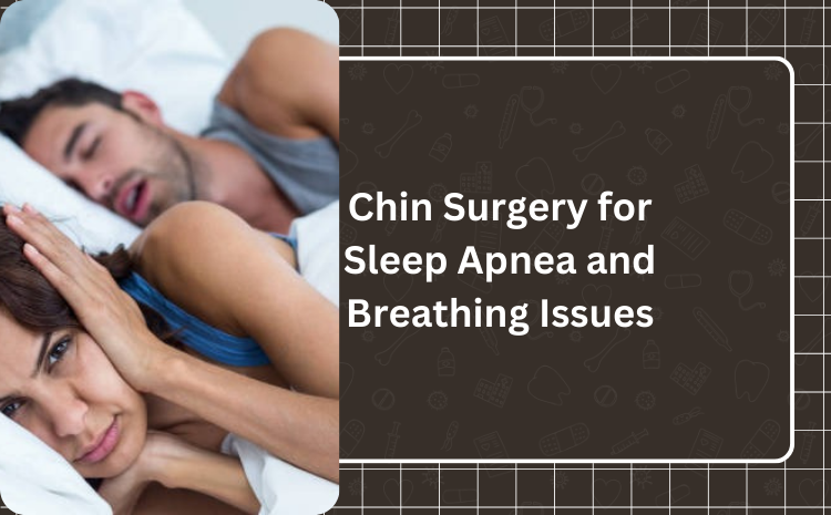 Chin Surgery for Sleep Apnea and Breathing Issues: A Comprehensive Guide