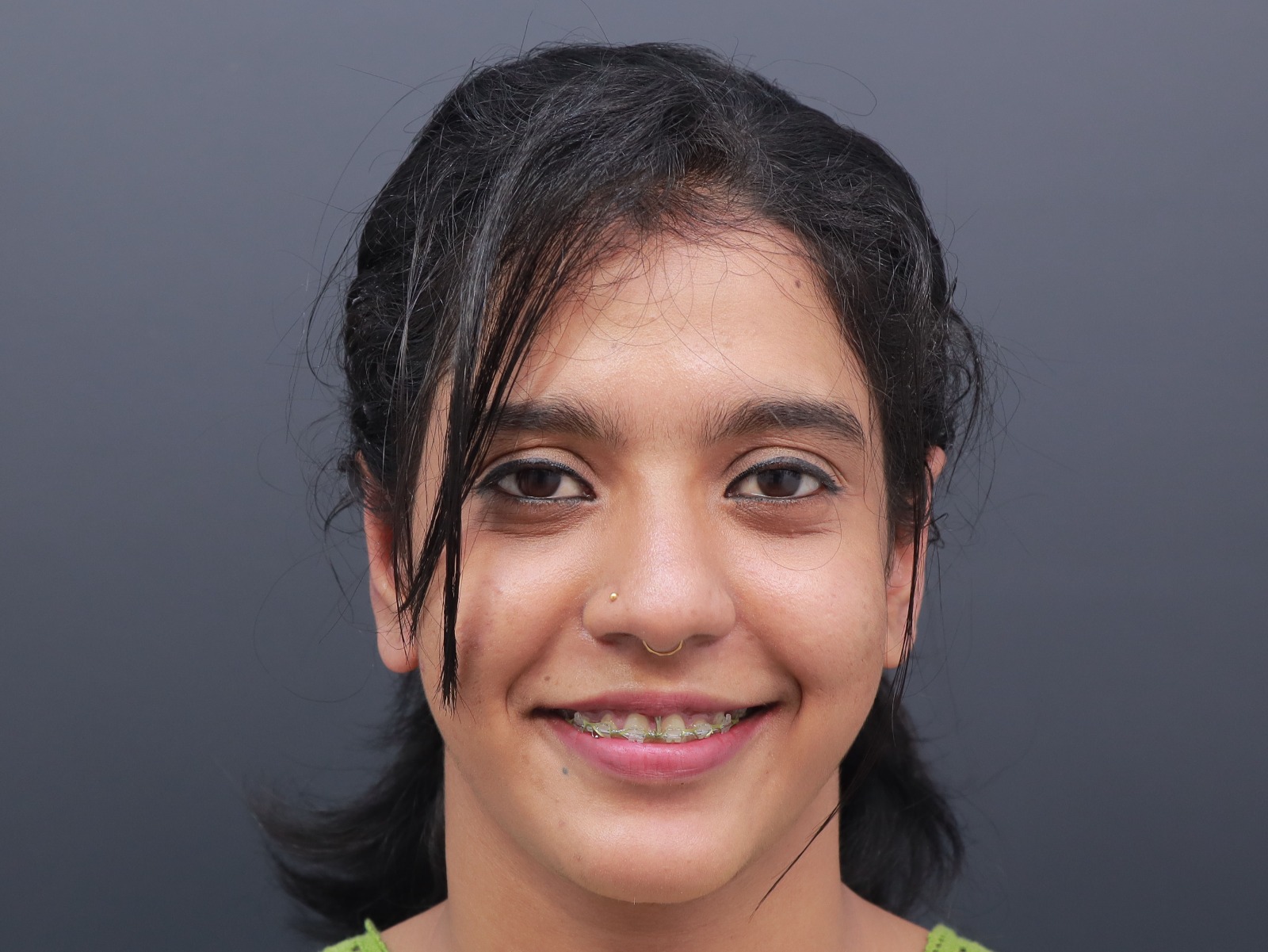 International Patients - Facial Surgery in India