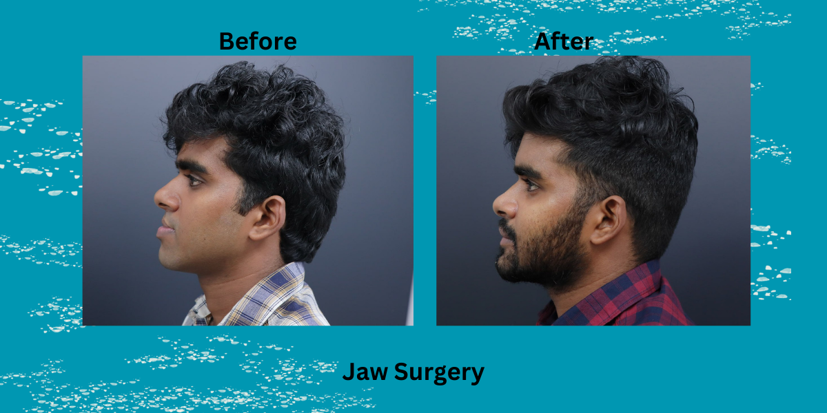 best jaw surgeon in india