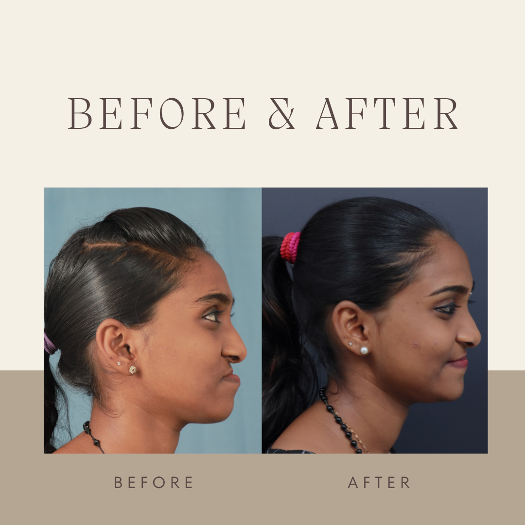 corrective jaw surgery in kerala