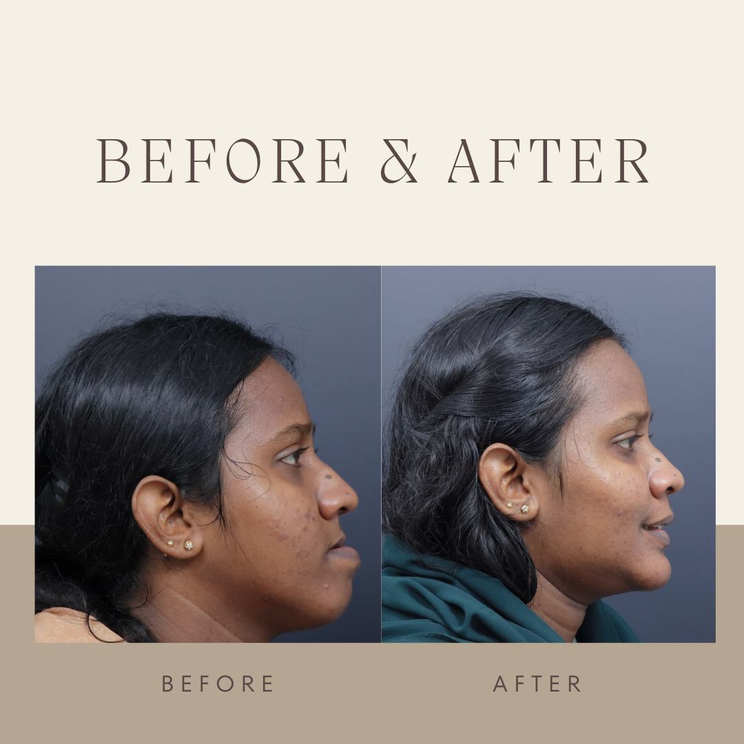 corrective jaw surgery in kerala