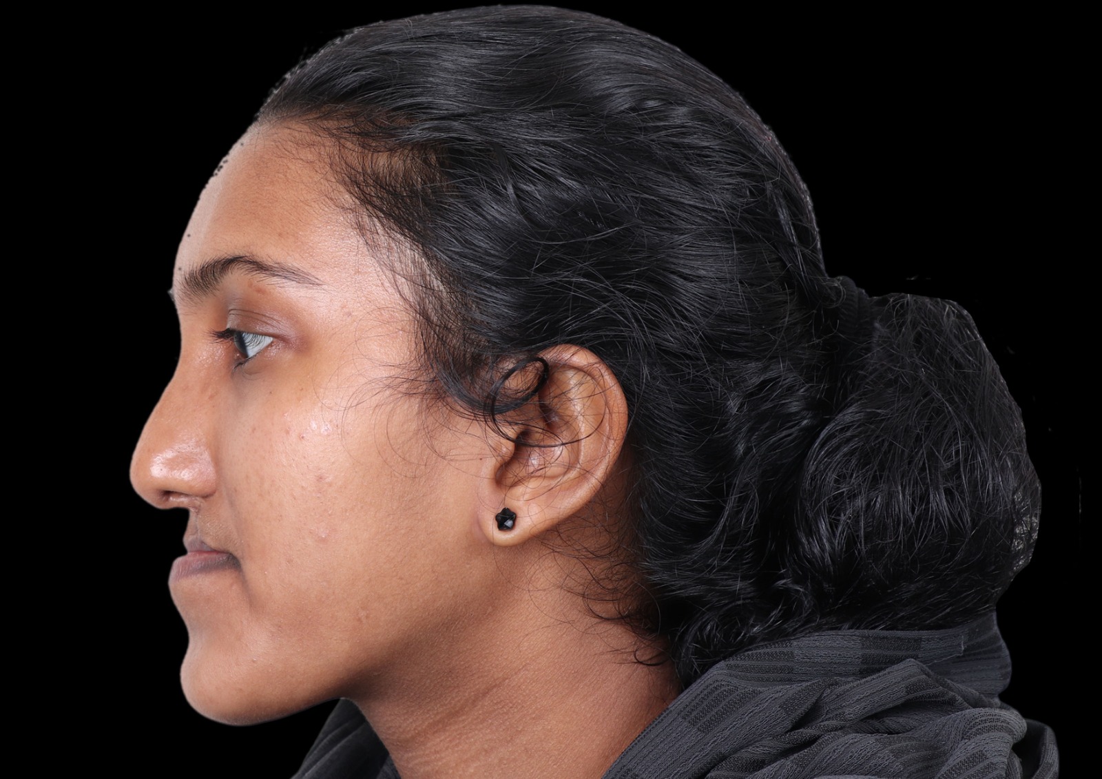 jaw surgery in india