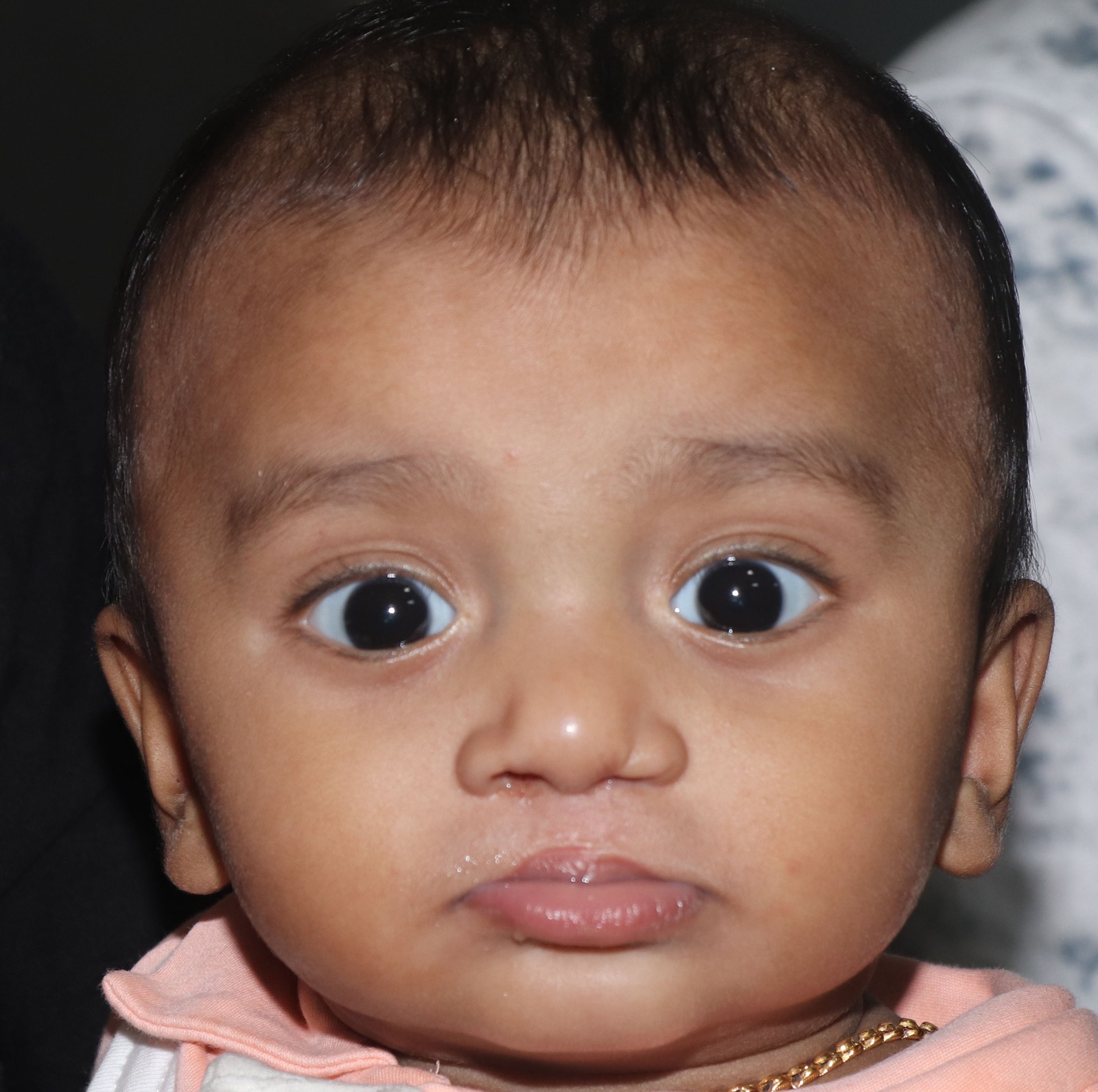 cleft lip surgery cost in india