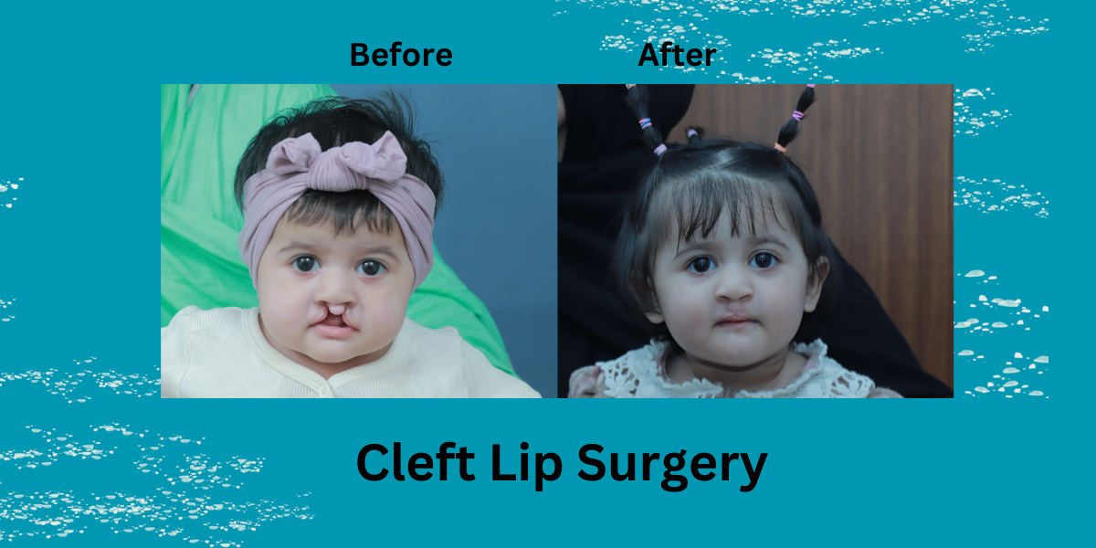 face surgery in India